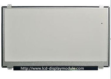 Τετραγωνική TFT διεπαφών MCU SPI ενότητα επίδειξης ΔΙΕΘΝΏΝ ΕΙΔΗΣΕΟΓΡΑΦΙΚΏΝ ΠΡΑΚΤΟΡΕΊΩΝ για το φορετό έξυπνο ρολόι